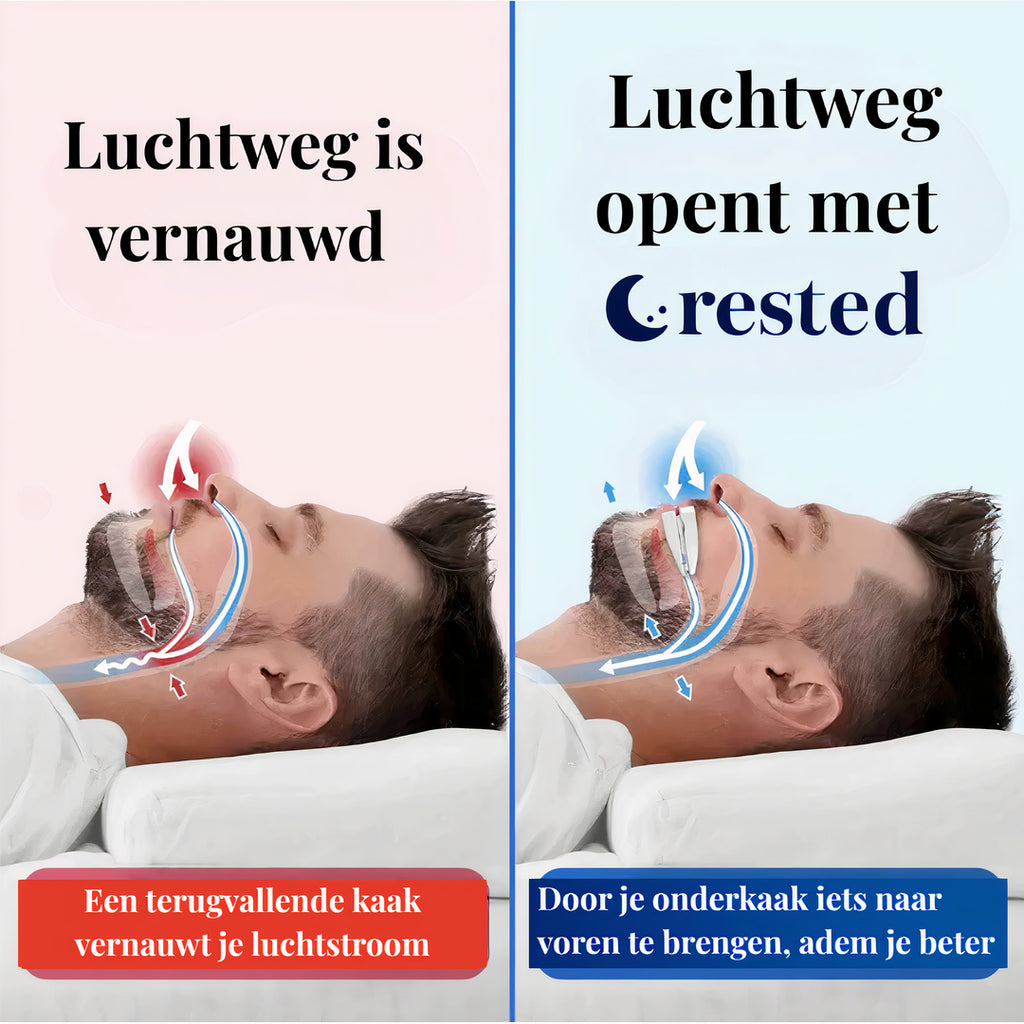 De Rested Apneubeugel
