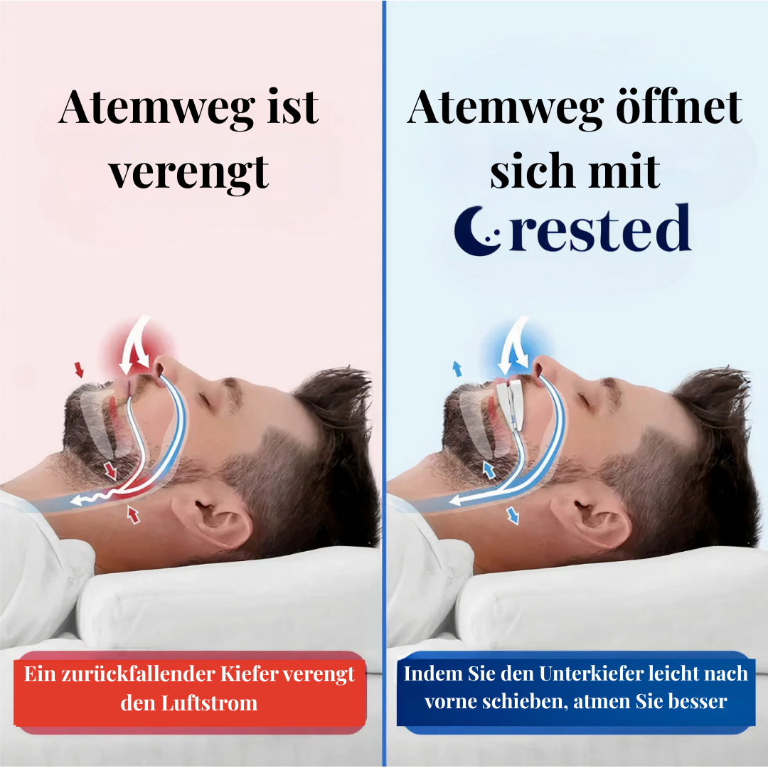 Die Rested-Schlafschiene